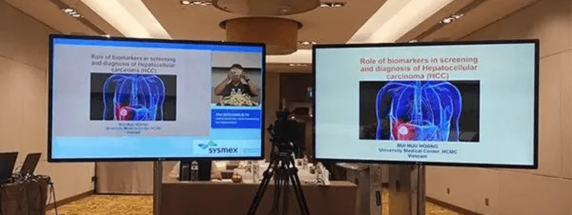 Cho thuê màn hình